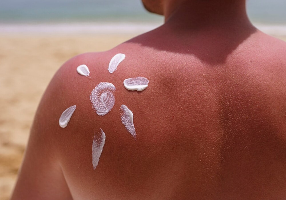 sunscreen